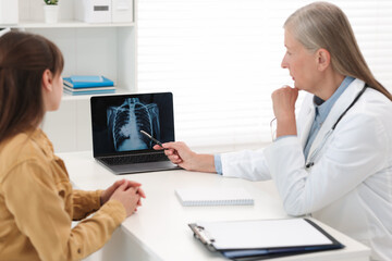 Lung cancer. Doctor showing chest x-ray on laptop to her patient in clinic