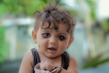 A Young Indian Toddler With a Black Eye Smiles Brightly While Playing Outdoors in the Sunshine