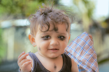 A Young Indian Toddler With a Black Eye and Smudged Face Beams Happily While Clutching a Checkered Cloth