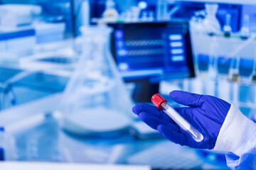 A person is holding a red and clear tube in a blue glove. The tube is labeled with a number and a letter. Concept of professionalism and precision