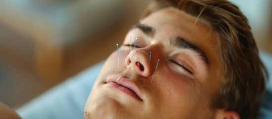 Close-up of Man Receiving Facial Acupuncture