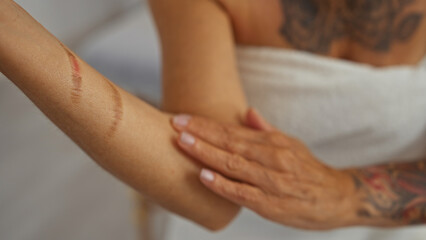 Woman applying lotion on arm with scars in spa setting, highlighting self-care, recovery, and...