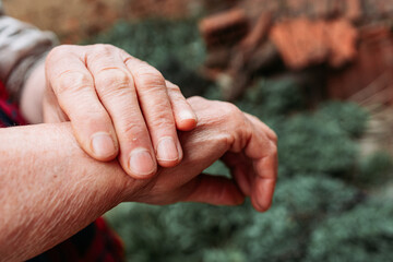 Elderly woman showing her hands joints