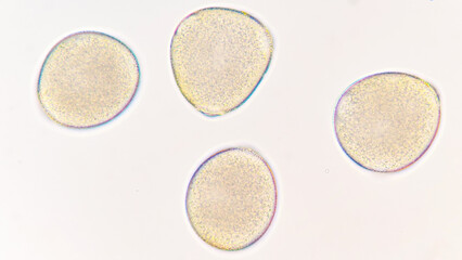 Melon (Cucumis melo) pollen grains under light microscope. Curcubitaceae pollen grains. 400x magnification + 2.8x camera zoom. Fresh sample. Selective focus image.