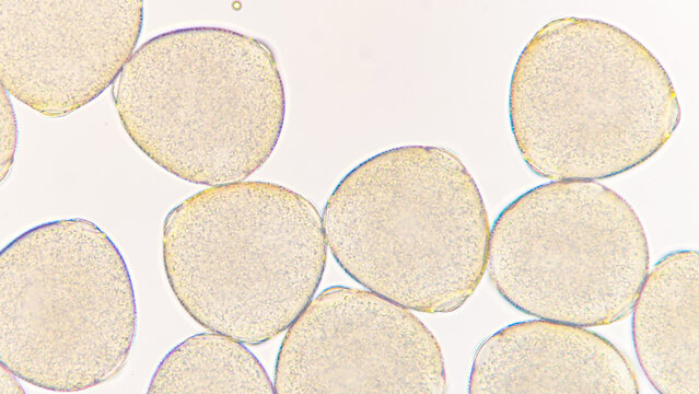 Melon (Cucumis melo) pollen grains under light microscope. Curcubitaceae pollen grains. 400x magnification + 2.8x camera zoom. Fresh sample. Selective focus image.