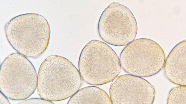 Melon (Cucumis melo) pollen grains under light microscope. Curcubitaceae pollen grains. 400x magnification + 2.8x camera zoom. Fresh sample. Selective focus image.