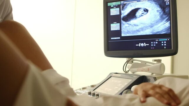 Vaginal ultrasound of a 7-8 week pregnant woman showing fetal heartbeat. Early pregnancy gynecological examination