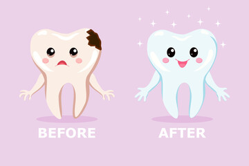 A sad tooth with caries and a healthy happy tooth before and after treatment. Dental treatment concept for pediatric dentistry. Cute dental cartoon characters.