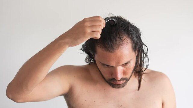 Using dermaroller on bald area improve hair regrowth,  latin man