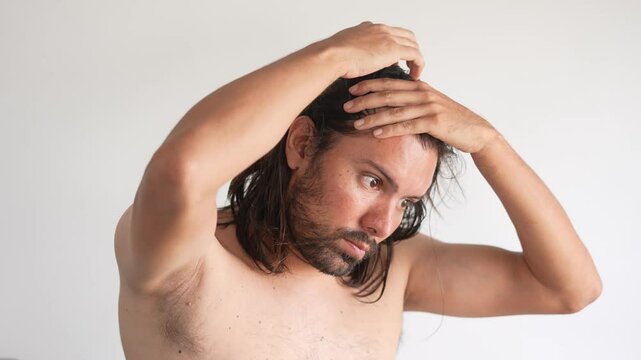 Male pattern baldness, man with hair loss problems, Derma Roller For Hair Loss, stop balding, Alopecia, Hair shedding