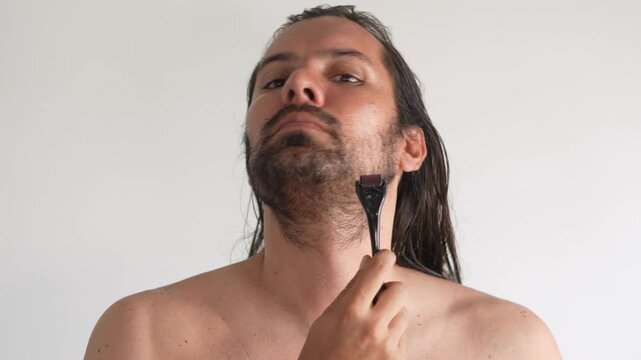 alopecia, Using dermaroller on bald area improve hair regrowth.