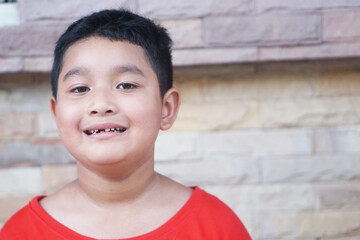 Asian boy wearing a red t-shirt, 7 years old Smiling, showing one broken upper baby tooth.