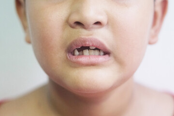 Asian boy 7 year old lost a tooth