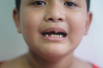Asian boy 7 year old lost a tooth