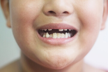 Asian boy 7 year old lost a tooth