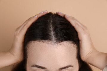 Woman with hair loss problem on beige background, closeup