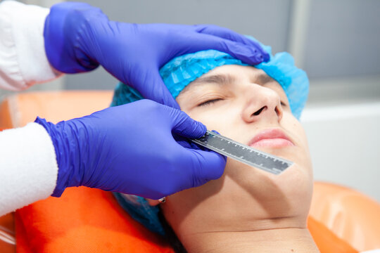 Skin lesion removal procedure. Dermatologist carrying out a removal of benign skin lesion on the face of a young male patient.