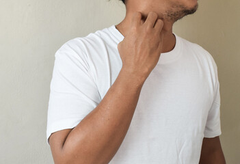 Itchy arms scratching healthcare and medicine health problem on beige background