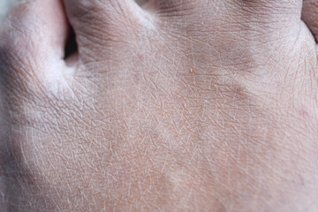 Closeup view of dry human skin .