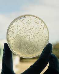 Recuento de bacterias a trasluz en placa de petri en laboratorio
