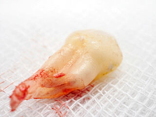 Close-up of tooth that had just been extracted had red blood stains stuck to the root, teeth from tooth extraction by the dentist, Tooth extraction concept, macro.
