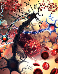 Ischemic brain stroke concept, illustration showing human brain and close-up view of blood vessel 