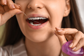 Young woman with dental braces using dental floss, closeup