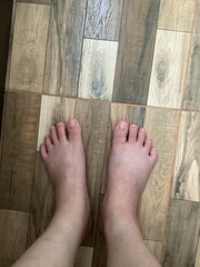 Feet