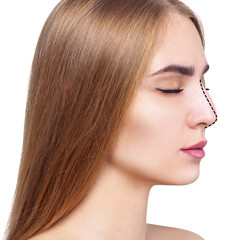 Fototapeta premium Woman before and after nose plastic surgery.