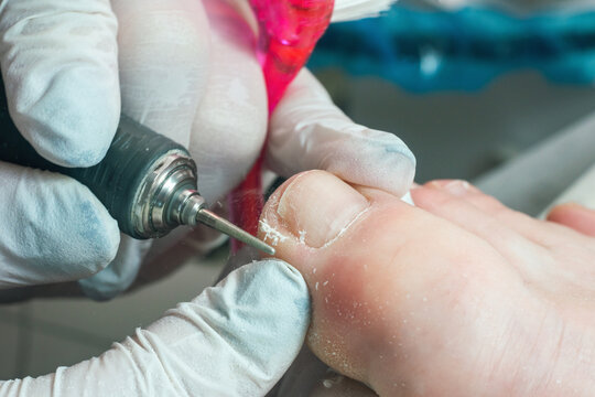 Professional hardware pedicurist, podiatrist cleaning nails using a nail miller