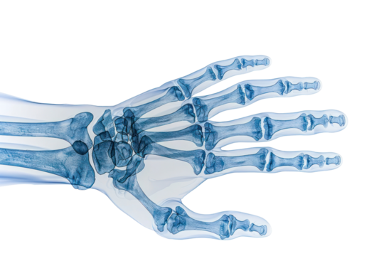 PNG  Detailed X-ray hand bones