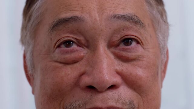 Close up of the senile cataract during eye examination. A white cloudy disc is seen in black eye circle, mature cataract, nuclear sclerosis cataract. Close up half face view