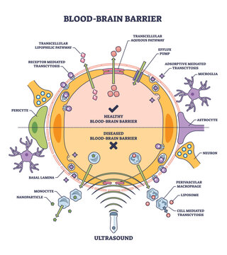 Blood brain barrier or BBB as immunological feature of CNS outline diagram, transparent background. Labeled educational medical scheme with healthy BBB and diseased comparison illustration.