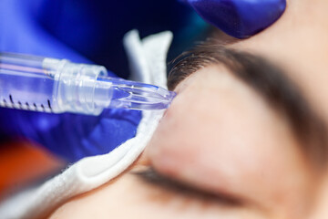 Female patient receiving a mesotherapy hydration procedure on eyelids with microneedles at...
