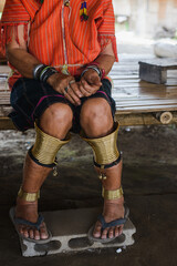 Arms and legs, body parts of the Karen people in Chiang Mai Province in northern Thailand