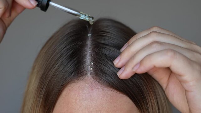 Young blonde woman applying essential cosmetic burdock oil with a dropper to the parting of the head with hands to strengthen, activate hair growth and reduce hair loss on a dark grey background