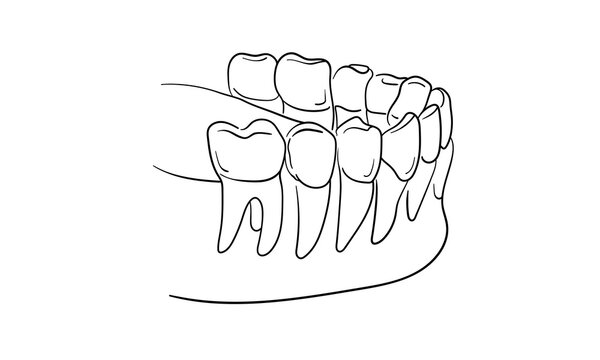 recommend clip art: Teeth with roots continuous line art drawing isolated on white background. Dentistry, health, midicine. Vector illustration	