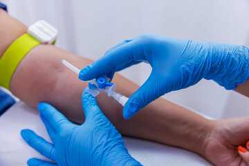 A patient with serum administered in the hospital. Serum is given to the patient. The serum that...