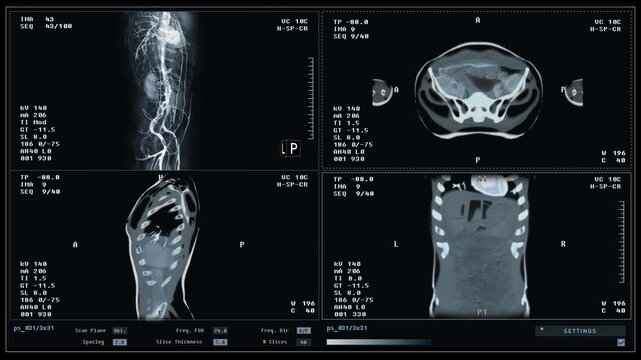 Modern scanner used during the medical examination of the patients chest. Medical scanner examining the organs of the sick person. Medical scanner examining the patients health at the hospital.