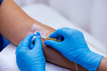 A patient with serum administered in the hospital. Serum is given to the patient. The serum that...