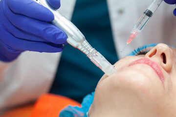Application of an anti-aging facial rejuvenation cocktail using micro needles. Dermatology concept....