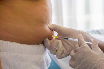 Carbon dioxide treatment on a woman's abdomen. Carboxitherapy