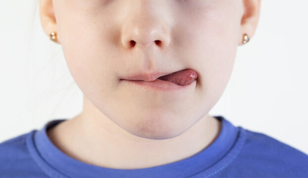 Child girl mouth with tongue. The concept of appetite in children, burring and failure to pronounce words, plasticity of the frenulum of the tongue. Dyslalia