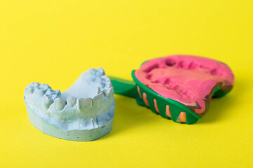 Dental spoon with alginate plastic mass for taking an impression of the dental jaw on a yellow...