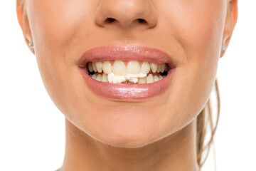 Closeup portrait of a young woman with chewing gum in her teeth.