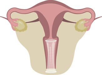 Vector illustration of a female condom.