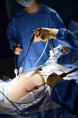 Doctor conducting laparoscopic operation on an abdominal cavity