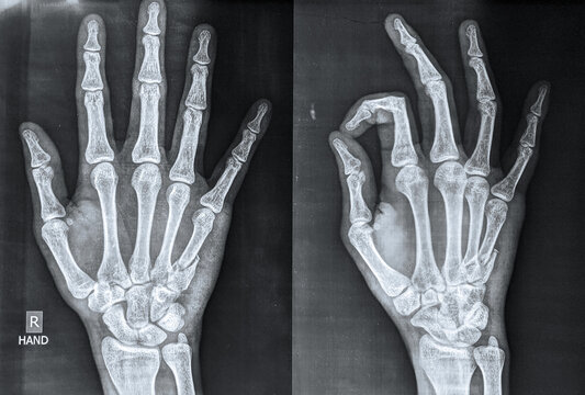 Skeleton X Ray Images Browse 172 132 Stock Photos Vectors and Video Adobe Stock