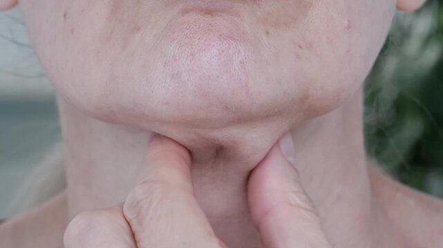 Close-up of a woman's neck showing signs of aging. The woman pinches her loose and sagging skin on her chin and neck. Concept of cosmetology and plastic surgery. Concept of skin care in old age.