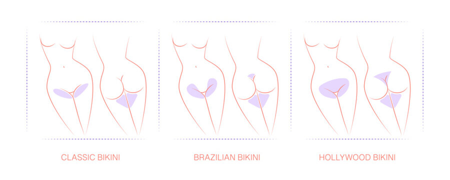 Diagram with designated areas for hair removal. Borders for hair removal: Classic bikini, Brazilian bikini, Hollywood bikini. Female epilation, depilation for girls.